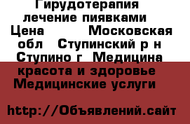 Гирудотерапия - лечение пиявками. › Цена ­ 200 - Московская обл., Ступинский р-н, Ступино г. Медицина, красота и здоровье » Медицинские услуги   